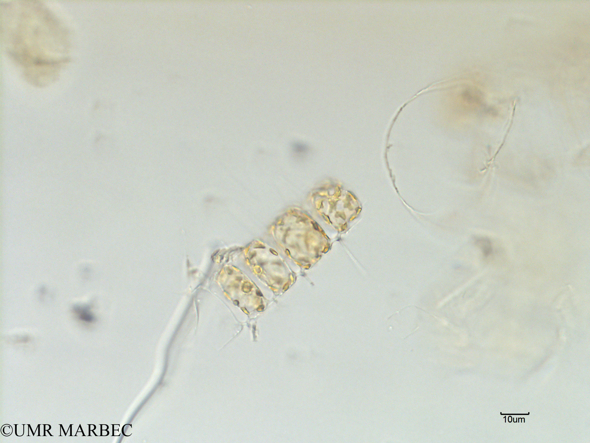 phyto/Scattered_Islands/mayotte_lagoon/SIREME May 2016/Chaetoceros sp35 (MAY3_chaetoceros_5-8).tif(copy).jpg